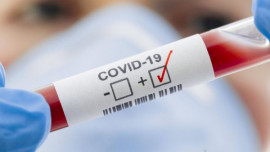 На Дніпропетровщині від COVID-19 померли двоє людей На Дніпропетровщині від COVID-19 померли двоє людей