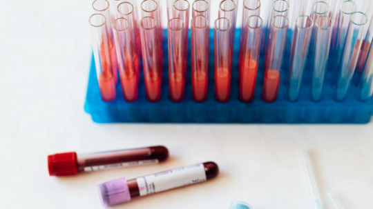 Захворюваність на ГРВІ у Дніпропетровській області впала більш ніж на 25%