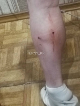 У Кривому Розі зграя собак напала на жінку