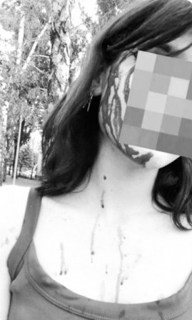 У Кривому Розі безпритульний собака напав на 16-річну дівчину