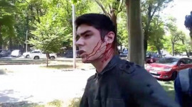 В покушении на одесского активиста подозреваются криворожане В покушении на одесского активиста подозреваются криворожане