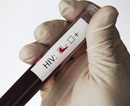 За неделю 14 криворожан узнали о своем положительном ВИЧ-статусе