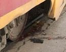 В Днепропетровске трамвай отрезал ногу мужчине