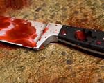 В Кривом Роге мужчину изрезали кухонным ножом