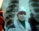 В Кривом Роге снизился уровень заболеваемости туберкулезом