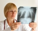 В Украине стабилизировалась ситуация с распространением туберкулеза